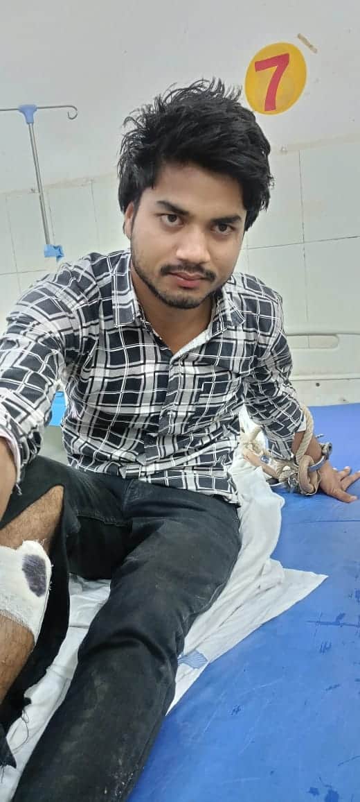 तोड़ार मोड़ के पास पुलिस मुठभेड़ में घायल किशोरी के साथ हुए बलात्कार का आरोपी कौशल गोंड। स्रोत-