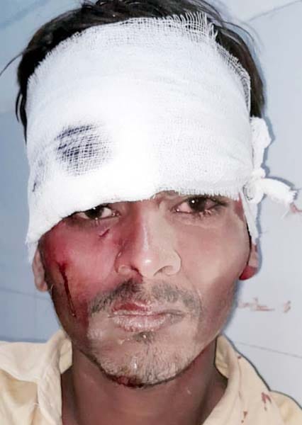 Two laborers injured after a trolley loaded with bricks overturns on the highway in Khutar.