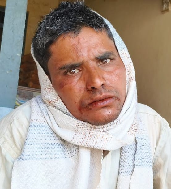 A leopard attacked a Kshetra Panchayat member who had gone to the farm