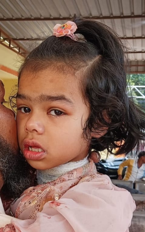 Case filed against unknown person in case of child being injured by dangerous thread