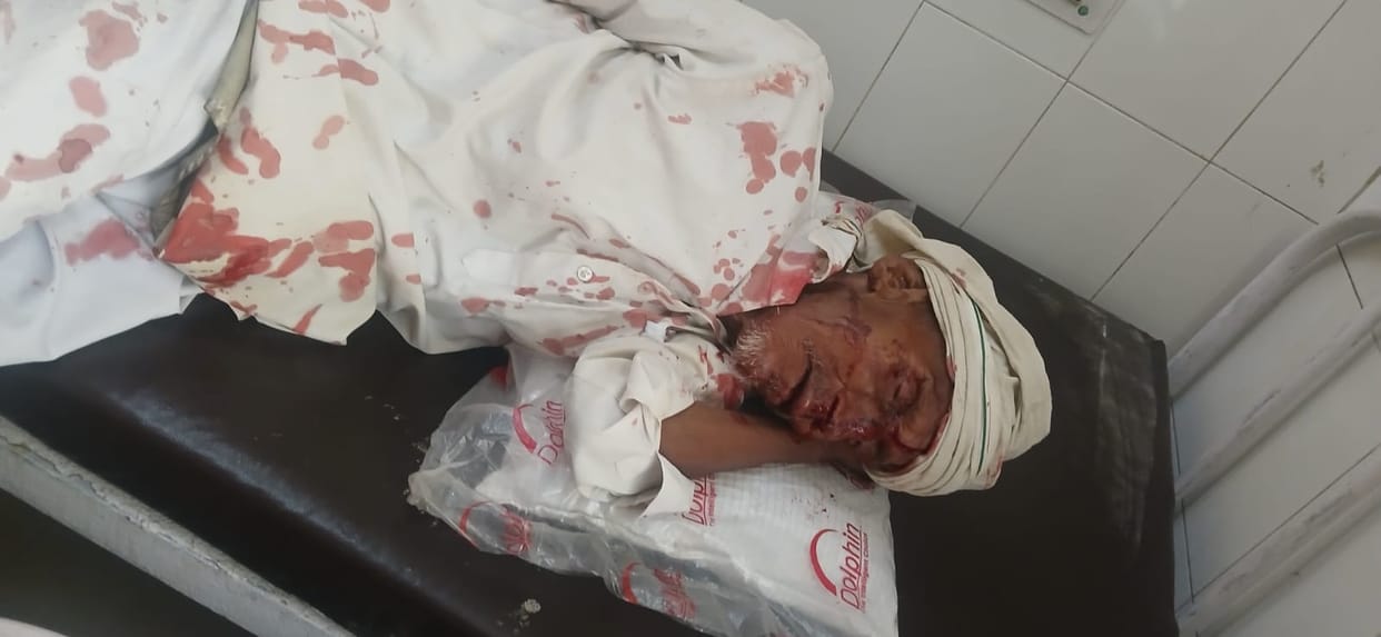 Nine injured in collision between tempo and bike