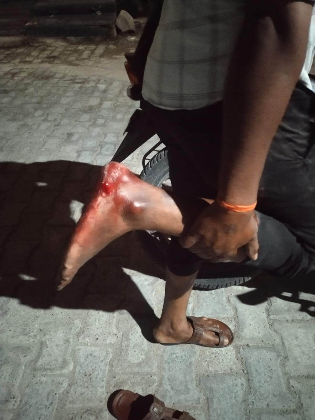 03- गंगा नगर गली नंबर 5 में कुत्तो के हमले से घायल युवक।संवाद