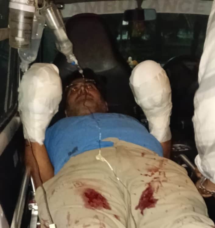 अंबाला कैंट के रामबाग रोड पर हुए हमले में दोनों हाथों के अंगूठे कटने पर घायल हुए थे संजीव: सोशल