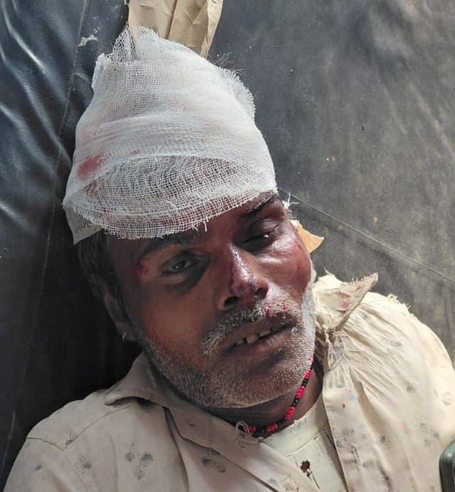 Bike collided with bicycle, wife dies, husband and another injured