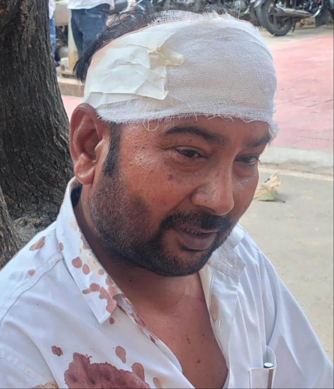 हमले में घायल प्रधान रामशंकर