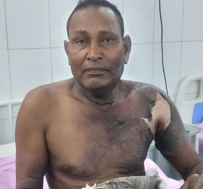 Farmer burned in a land dispute, former head and his son accused