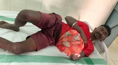 Youth Slips from Moving Train Palm Injured Condition Critical