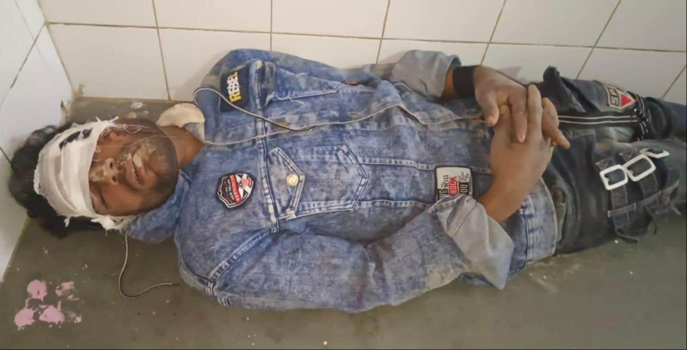  मल्हीपुर सीएचसी में भर्ती घायल