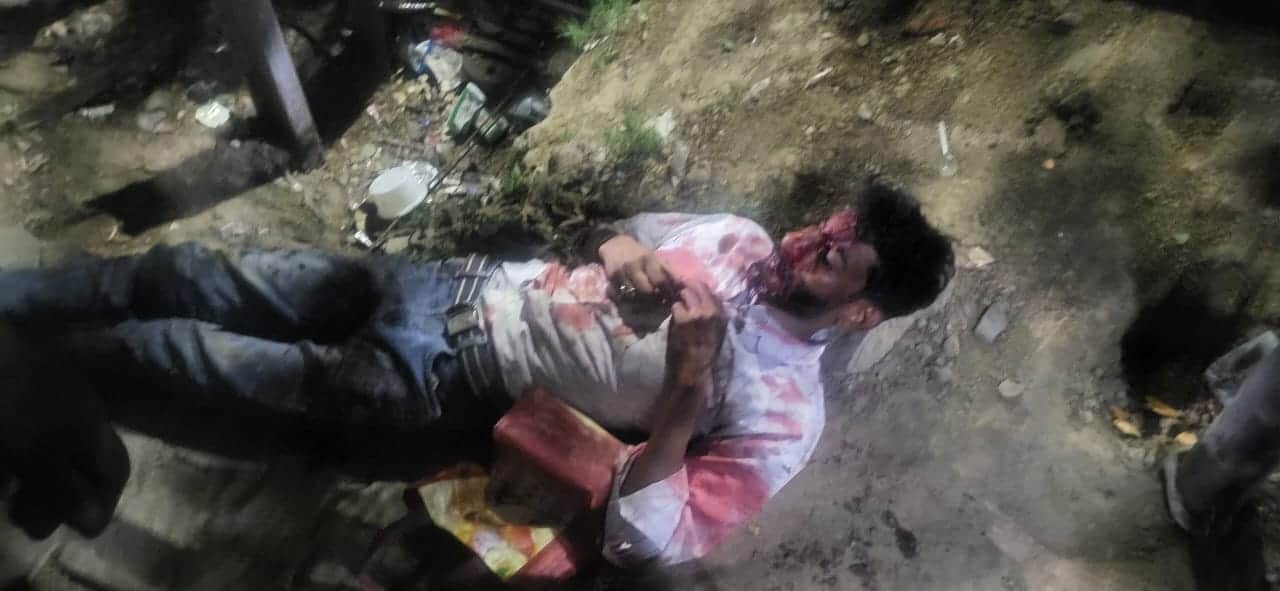 नया रेलवे स्टेशन फाटक पर रेल की टक्कर से घायल । स्रोत: वीडियोग्रौब