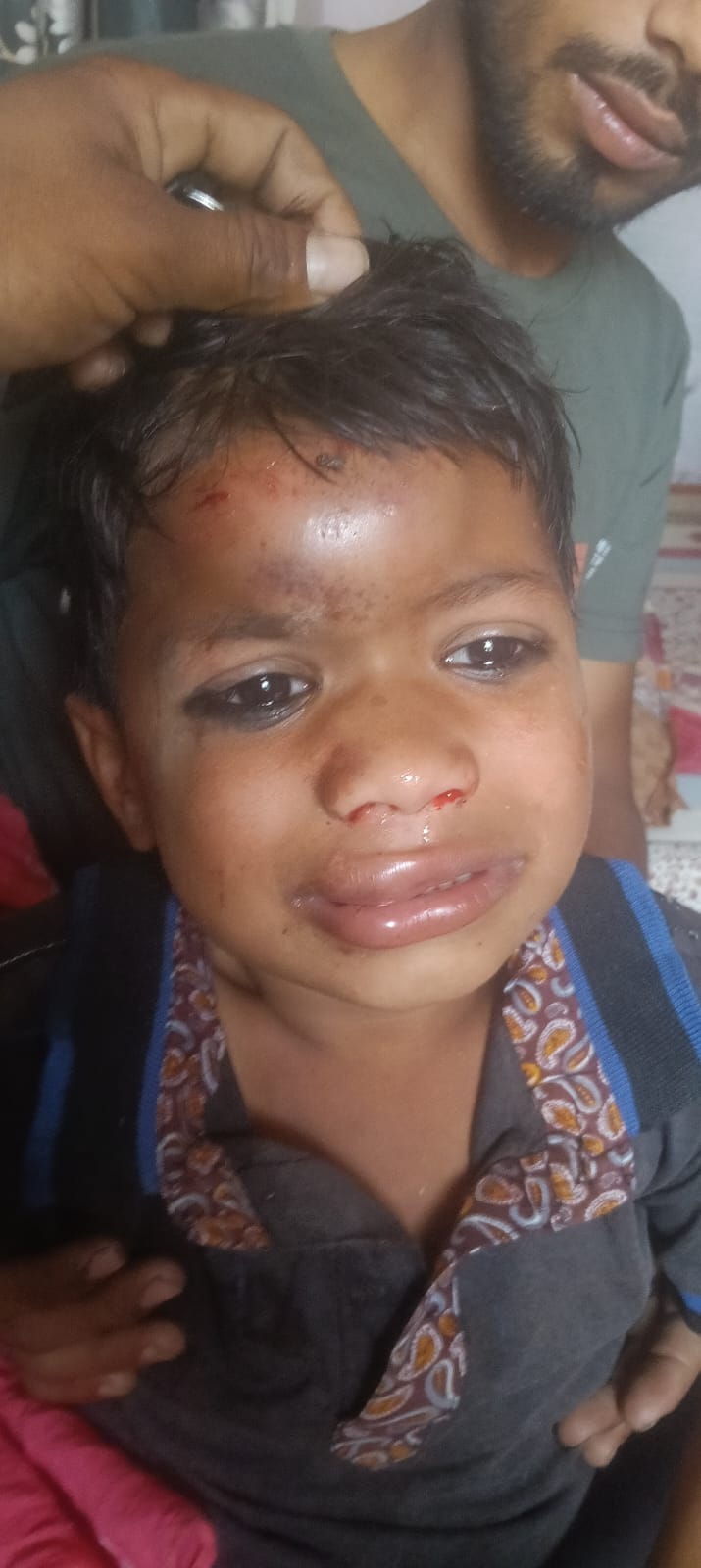 A damaged gate of an Anganwadi centre fell on three children, seriously injuring them