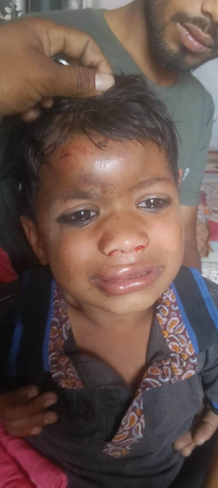 मोदीनगर के गांव आबिदपुर मानकी में आंगनबाड़ी केंद्र के मुख्य द्वार पर गेट का एक हिस्सा गिरा घटना