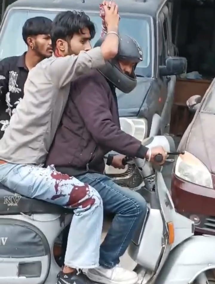 Bloody clash in Solan, two groups use sharp weapons and rods on Mall Road