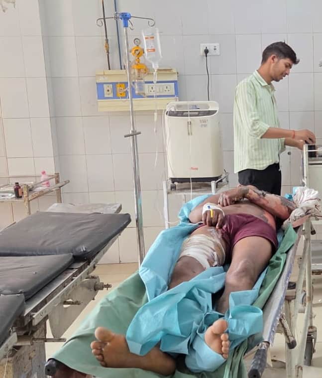 बिजली से झुलसे संविदाकर्मी का जिला अस्पताल में चल रहा उपचार।
