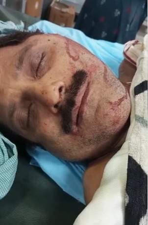 A shopkeeper was beaten with sticks while returning home after closing his shop, blood oozed from his ears.