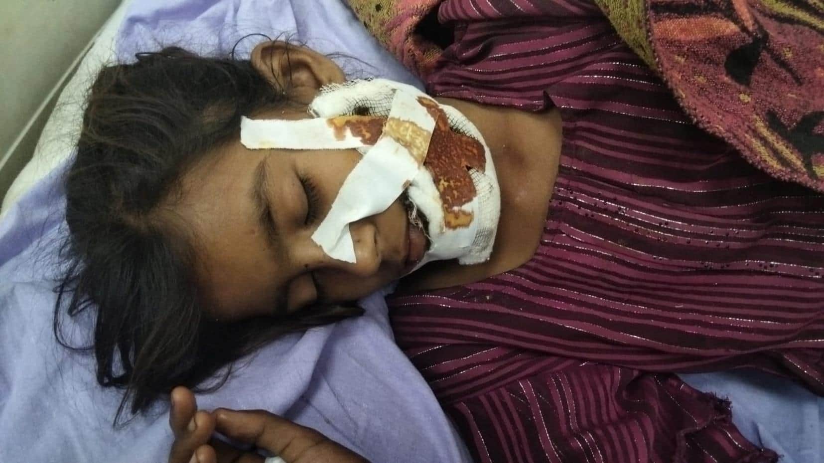 कुत्ते के हमले में घायल रूपा।     -संवाद