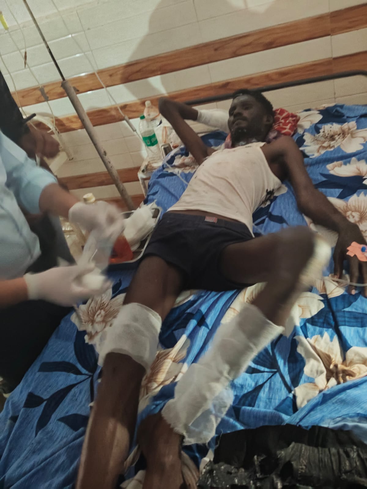 A fire broke out while repairing a leaking cylinder, burning six people, including an innocent child.