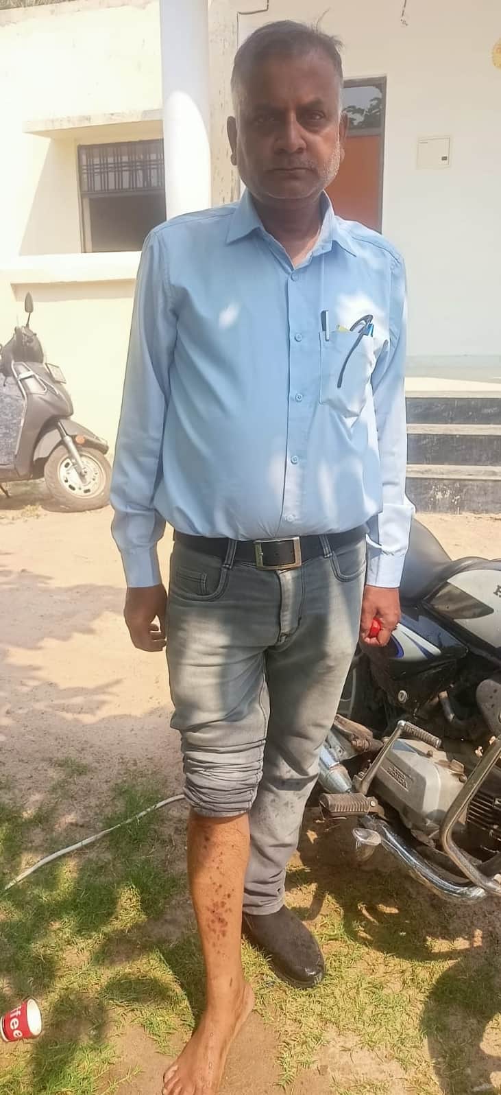 कुत्ते के हमले में जख्मी लोग और कुत्तों को पकड़ने पहुंची टीम।