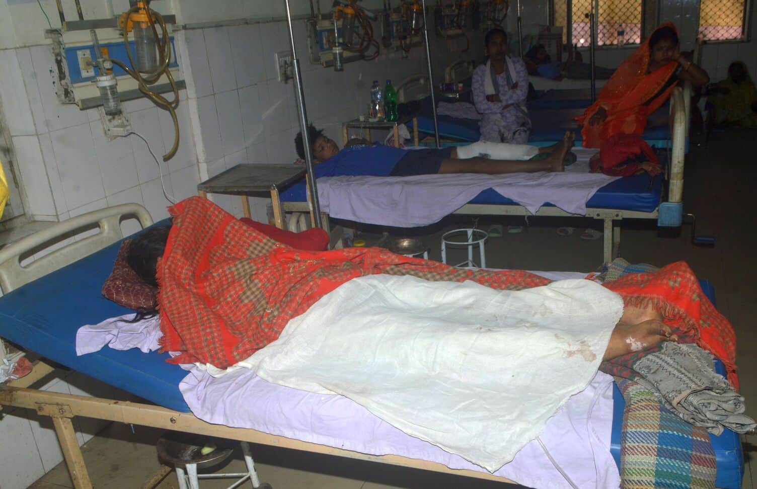 फोटो-07- मेडिकल कॉलेज के सर्जिकल वार्ड में भर्ती वर्न का मरीज। संवाद