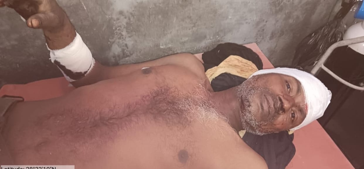 A labourer peeling sugarcane was attacked and injured by a tiger.