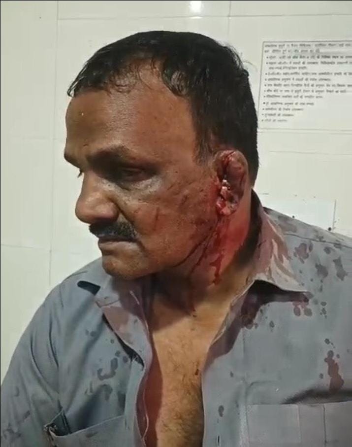 In a dispute over soil removal, the guard was attacked with a shovel and his ear was cut off.