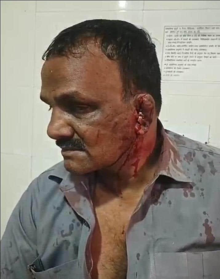 फावड़े से हुए हमले में घायल राजेश यादव।