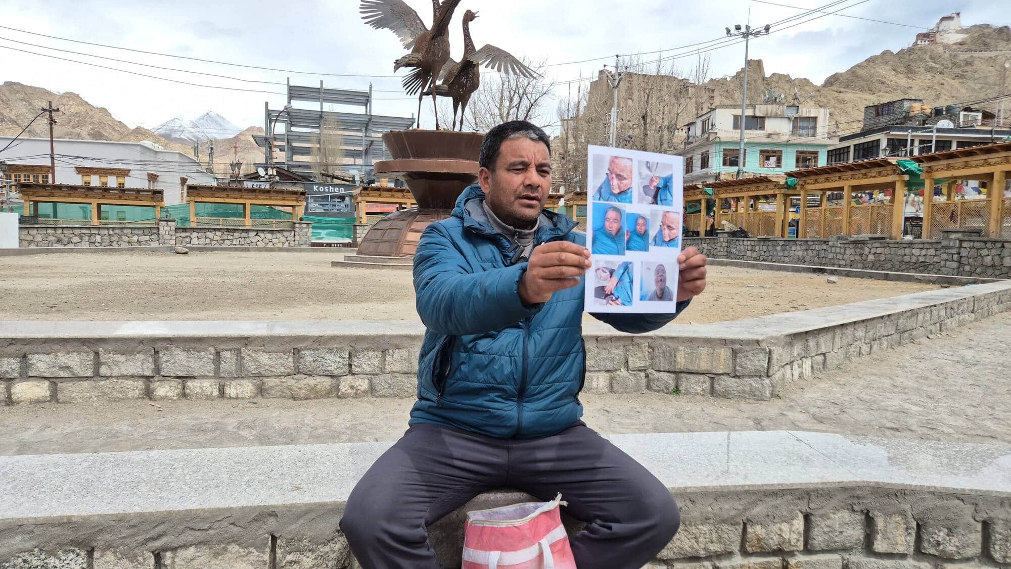 शिकायतकर्ता अपनी चोटों की तस्वीर दिखाते हुए।स्रोत - संवाद