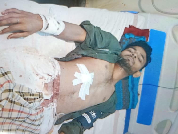 Bihar News :young man shot twice neighbour treatment in DMCH