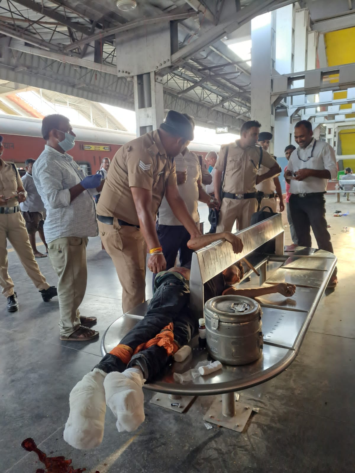 घायल का इलाज जारी