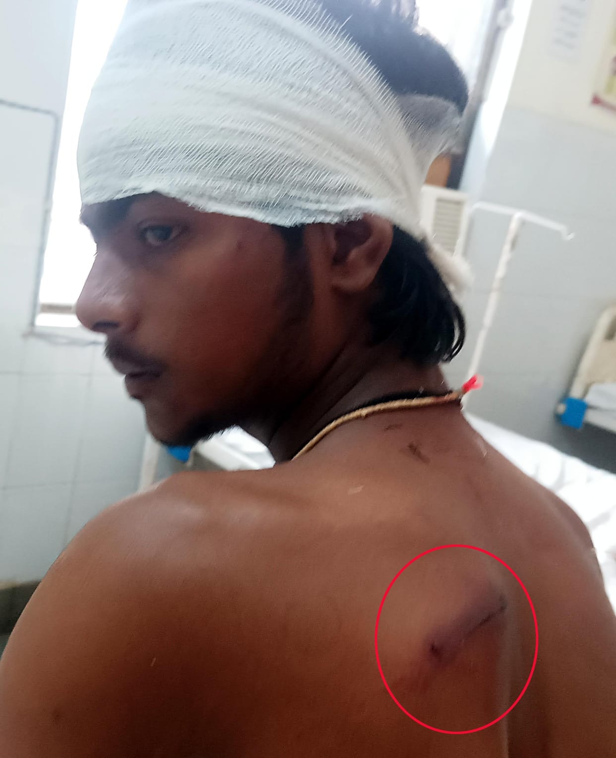 Youth attacked with hockey sticks and gun butts in Bah