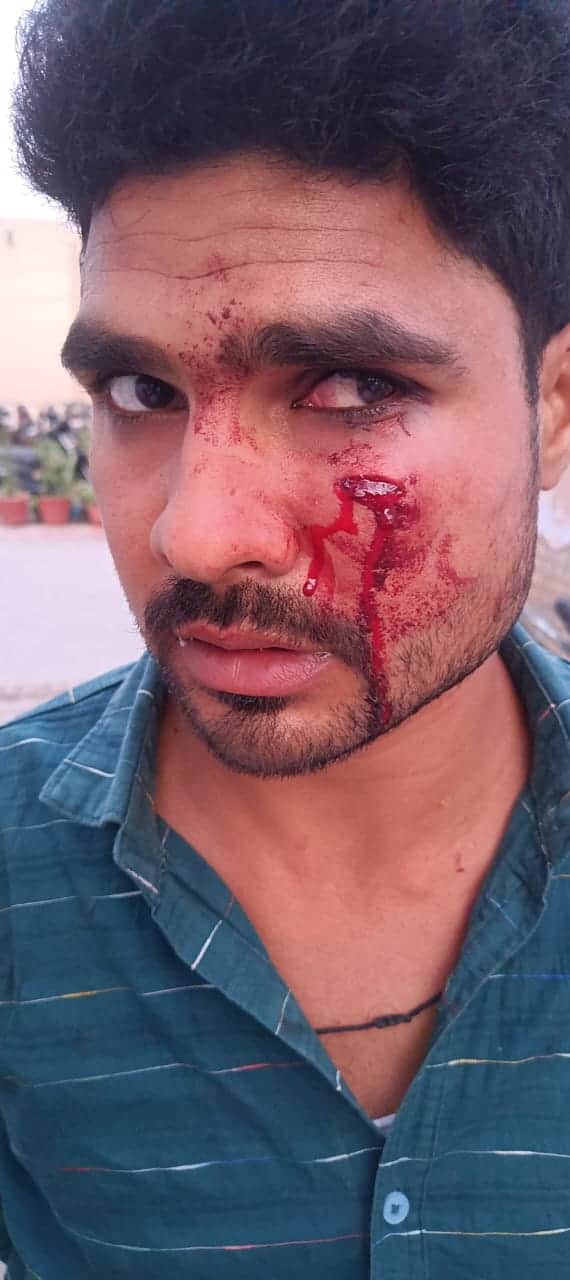 दौराला - हमले में घायल सिवाया गांव निवासी सलमान। स्रोत : संवाद