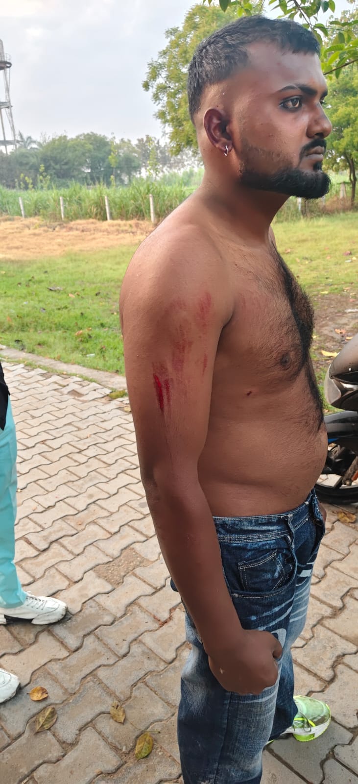Deadly attack on wedding party in parking dispute, six injured