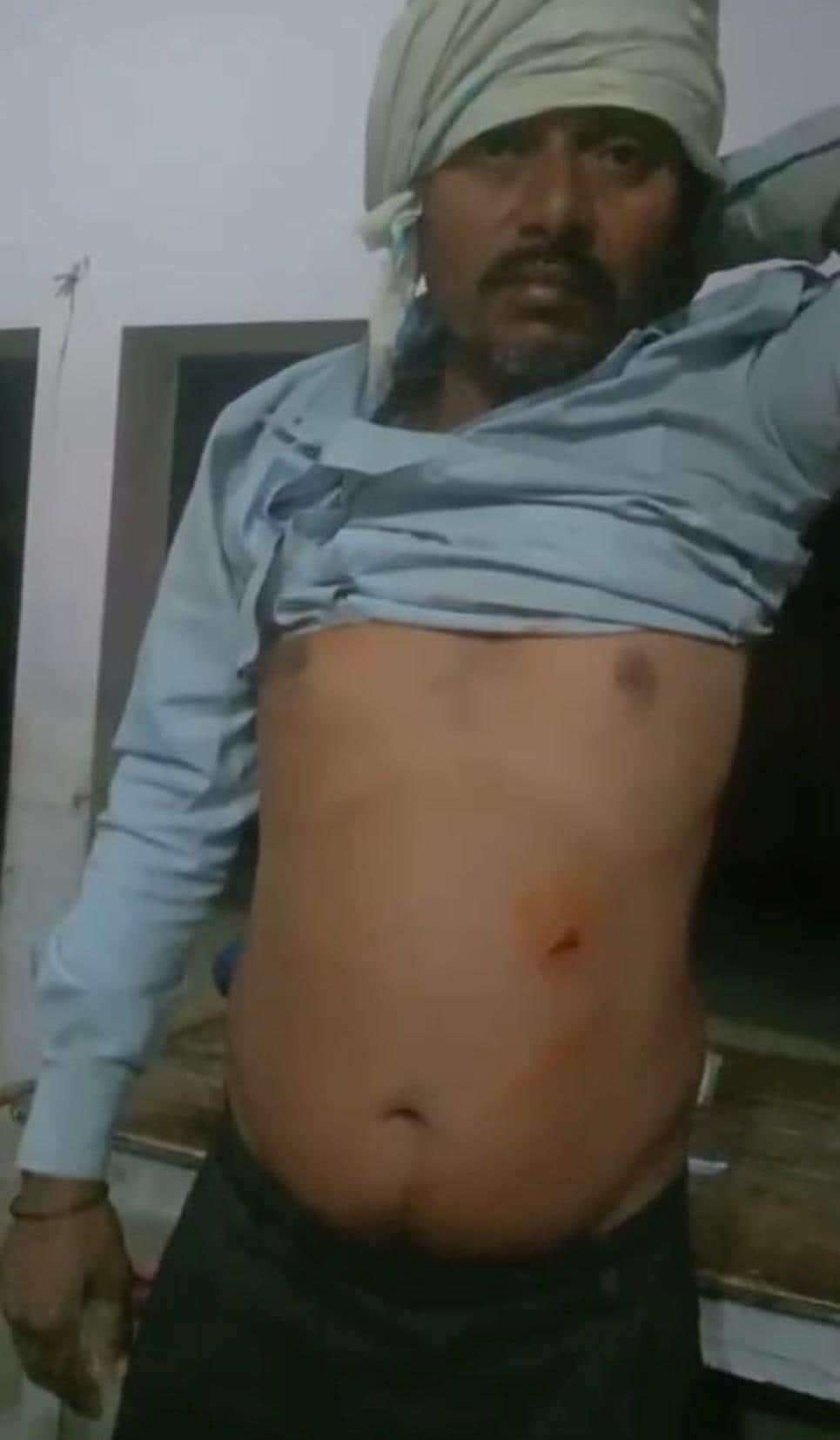 निशानगाड़ा रेंज में तेंदुए के हमले में घायल इंदर साहनी। 