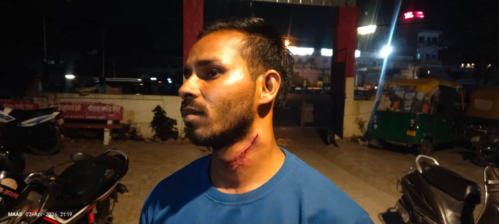 पीड़ित अरविंद यादव गले का निशान दिखाते हुए। संवाद