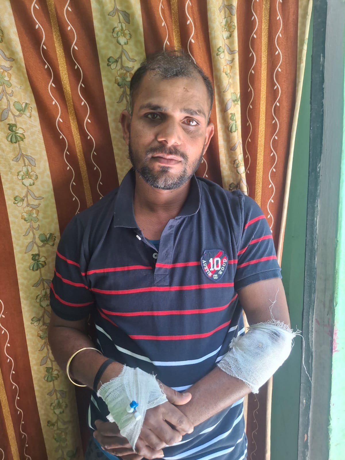 Monkeys bit six people, including a soldier, in three days.
