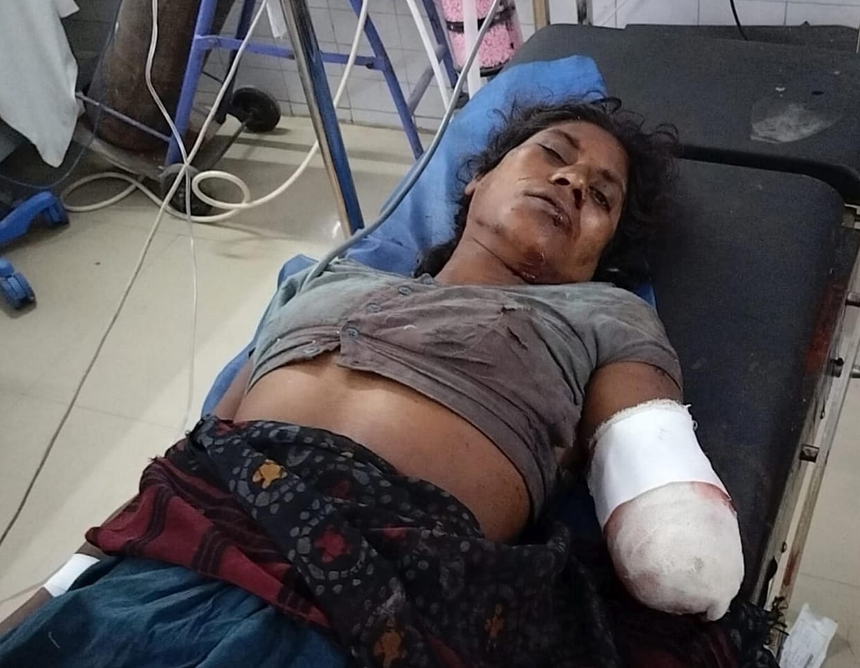 Tiger attacks woman, bites off hand