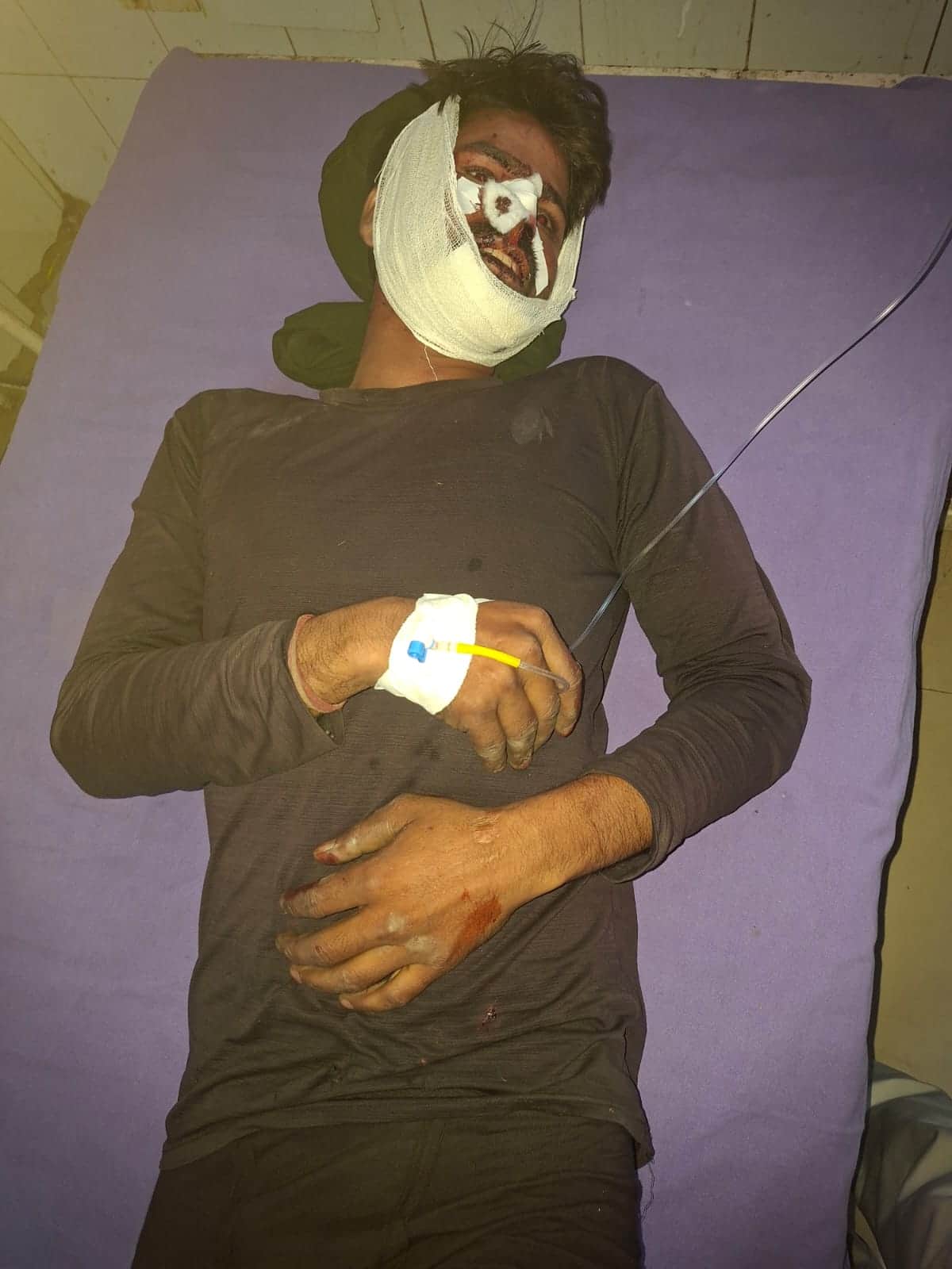 फोटो 38 जिला अस्पताल की इमरजेंसी में घायल लाइनमैन भूपेंद्र। संवाद