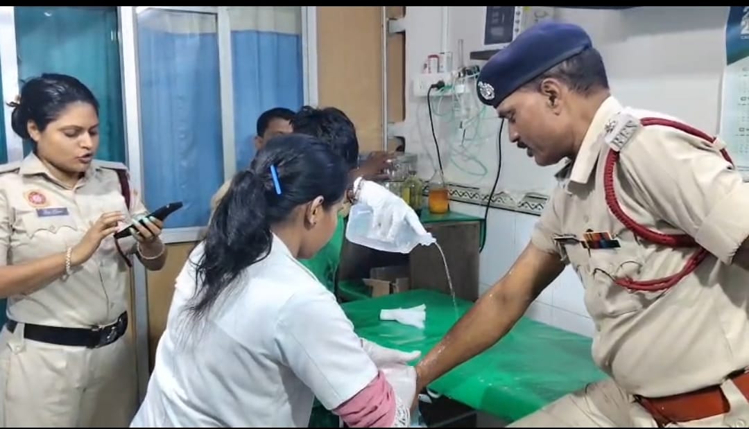 इलाज कराते झूलसे मरीज