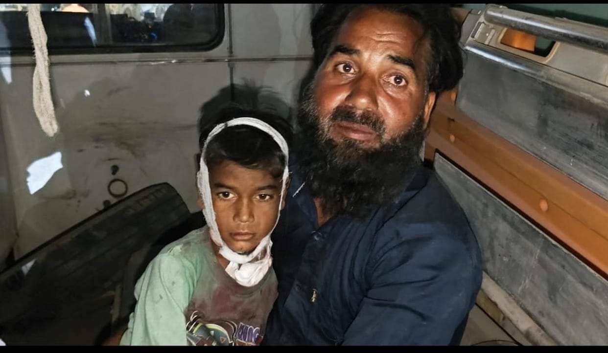 Leopard ran away carrying a child, father struggled to save his life
