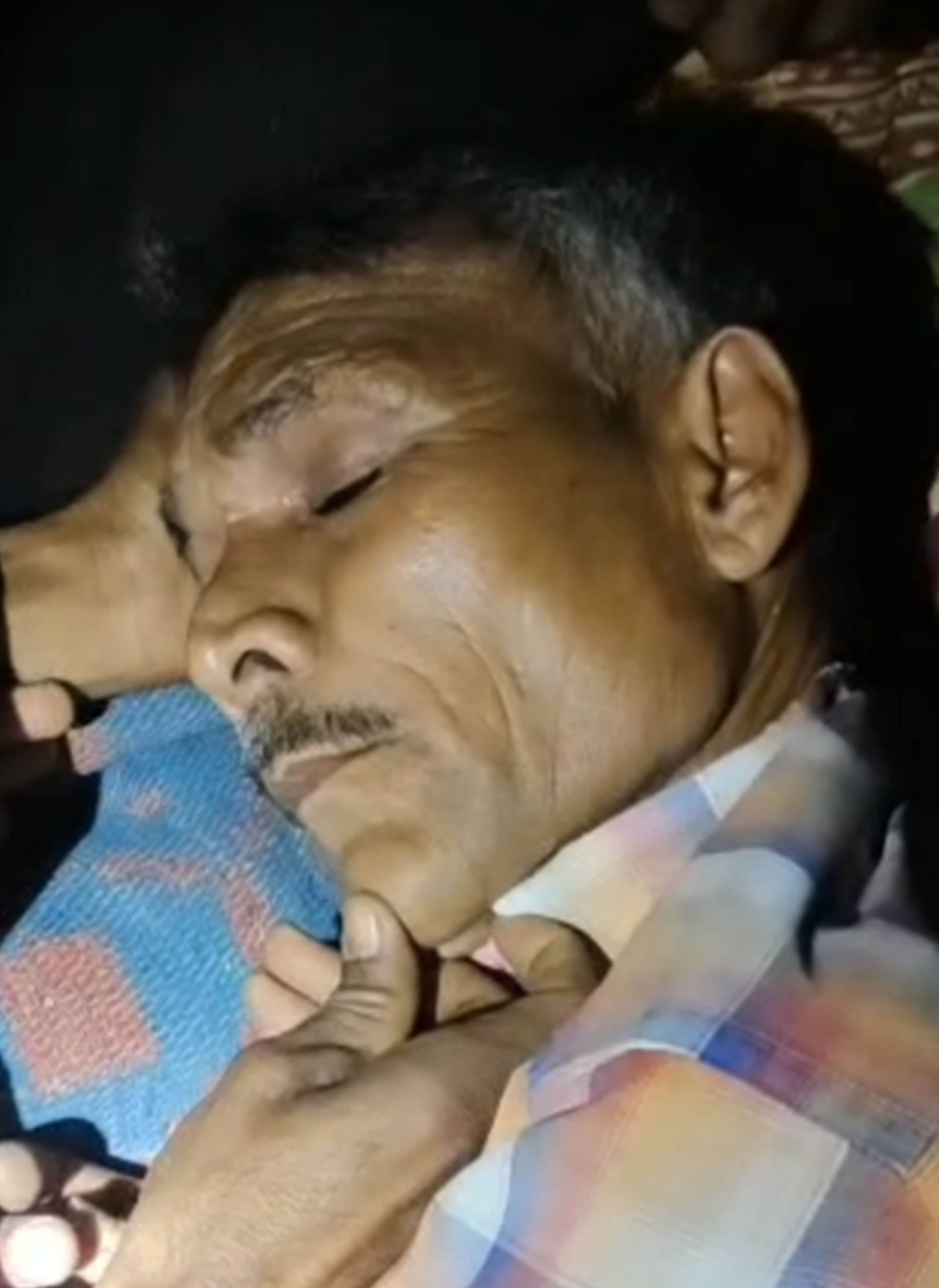 फोटो-10- घायल श्रीकेशन उर्फ शंकर। संवाद