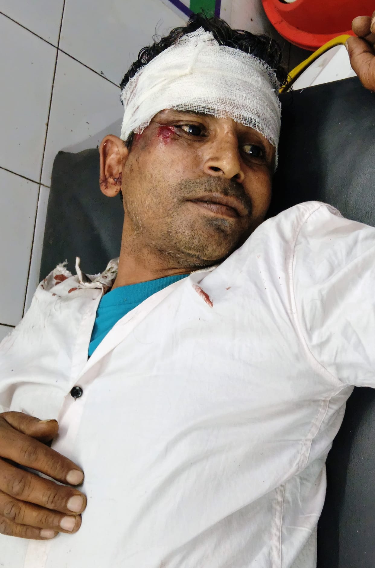 Bike collides with bull, four people including couple injured