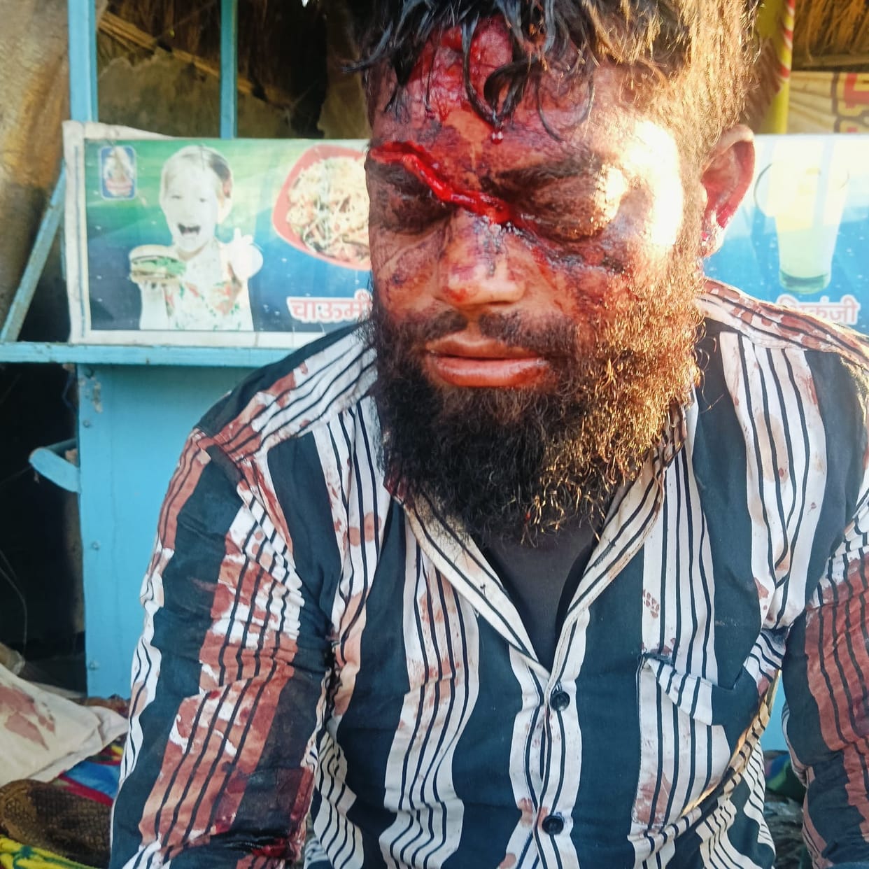 Fruit seller attacked with sharp weapons, condition critical