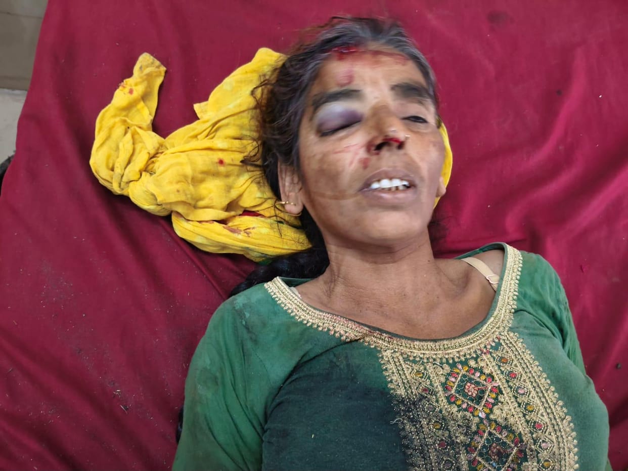 Allegations of firing and assault in land dispute