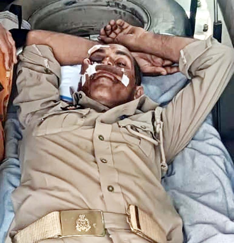 Home Guard Seriously Injured After Colliding with Stray Animal in Puwayan