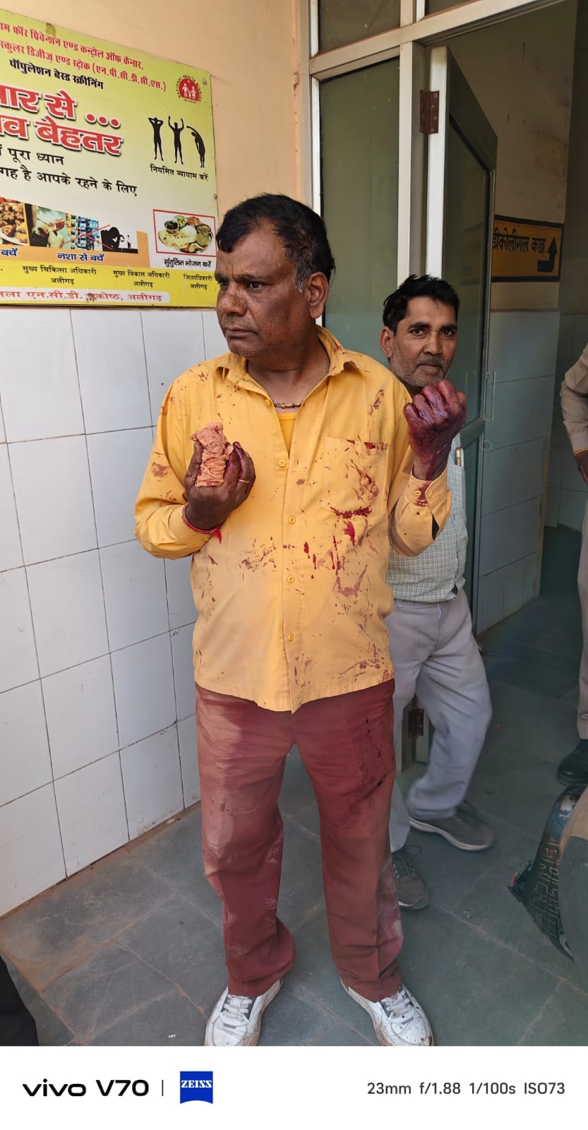 Brother-in-law attacked brother-in-law with an axe