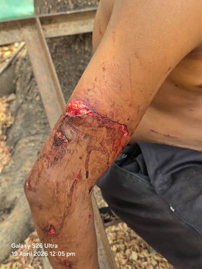 Leopard Attacks at Two Separate Locations Two Villagers Injured Treatment Underway in Bijapur