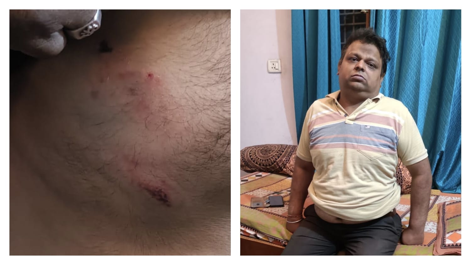 भालू ने कर्मचारी पर किया हमला