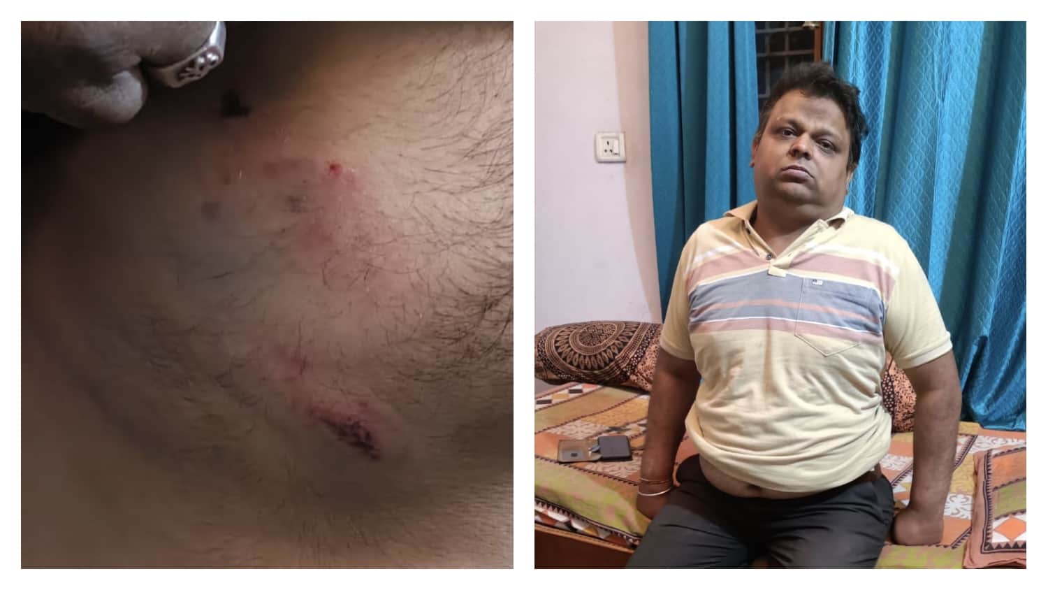 भालू ने कर्मचारी पर किया हमला