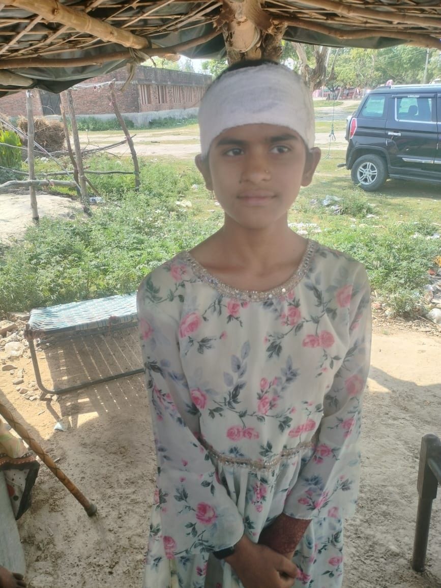 Stone pelters terrorize Bahrauli village, teenager injured