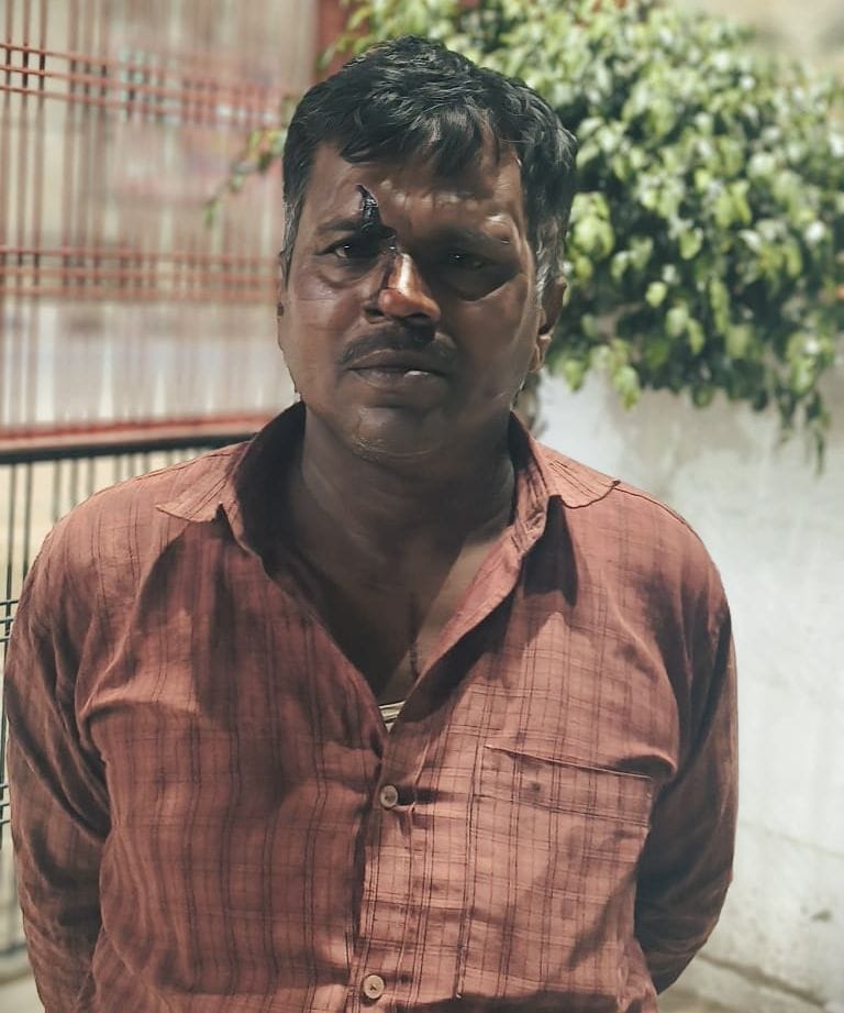 Woman head and her husband attacked for protesting against laying of electricity line
