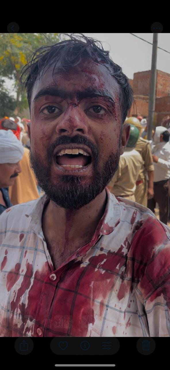 Stone-Pelting Clash Between SP Delegation and Villagers Lasts an Hour 12 Injured Including Former Minister